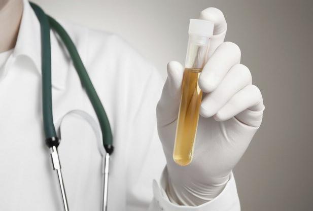 test urina