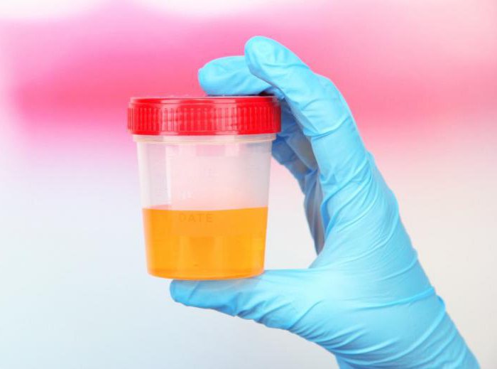 Kaj je urin za cistitis?
