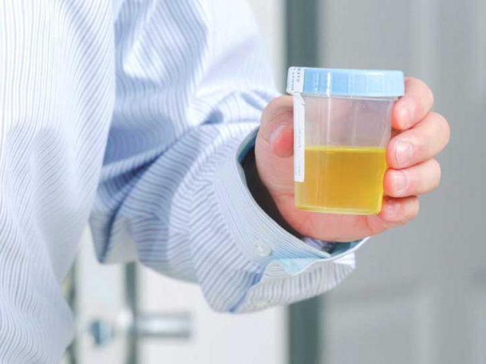 analiza urina