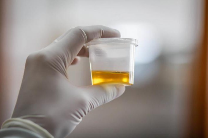 urina za indikatorje pielonefritisa
