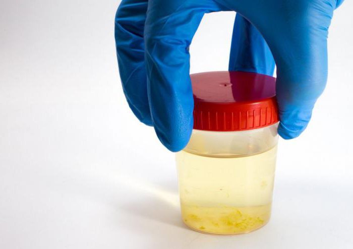 analisi delle urine per pielonefrite cronica