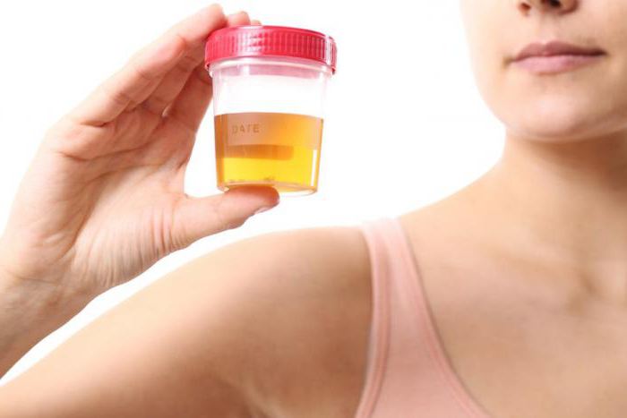 Analiza urina za pokazatelje pijelonefritisa