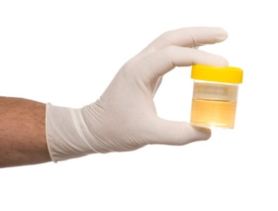 trascrizione dell'analisi delle urine