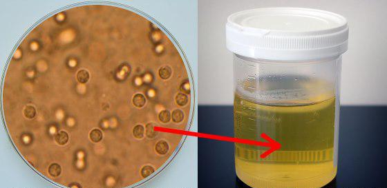 nitrit u urinu što znači