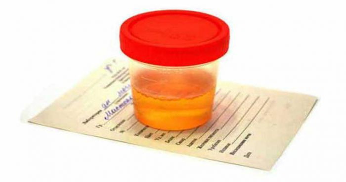 nitrita v urinu, kaj pomeni vzroki in zdravljenje