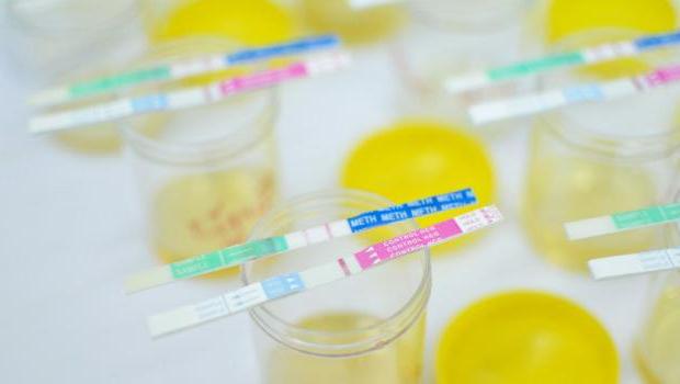 analisi delle urine per la semina