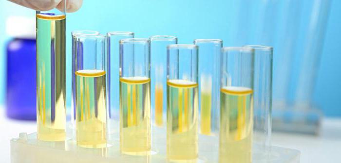 analiza urina za setev rezervoarja