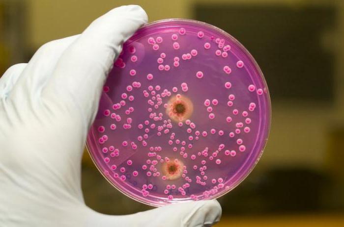 analisi delle urine per la semina della sensibilità agli antibiotici