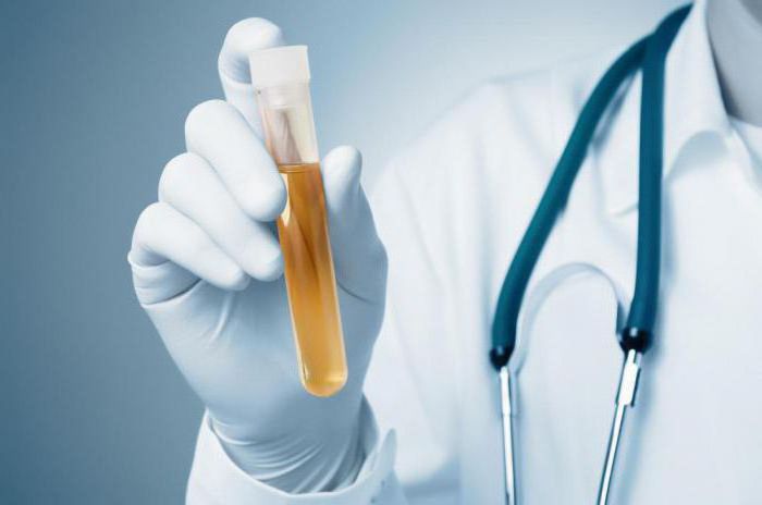 analiza transkripta urinske kulture