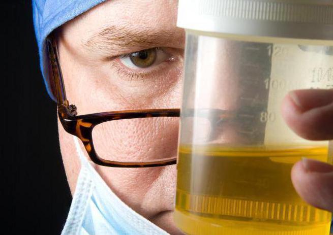 urobilinogena v urinu, kaj to pomeni