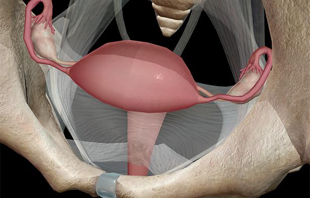 dimensioni del mioma uterino per la chirurgia