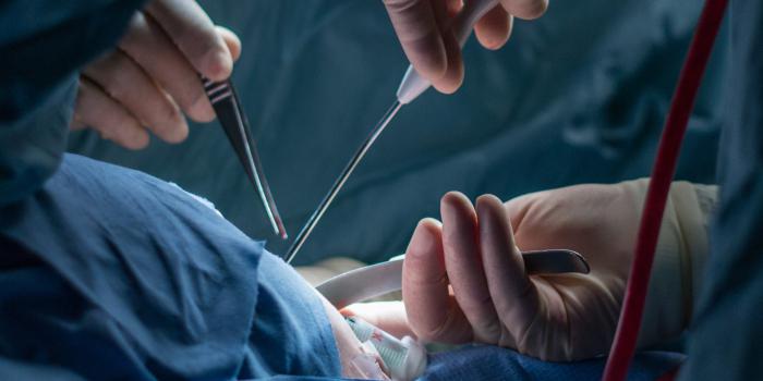 operacije uklanjanja fibroida maternice