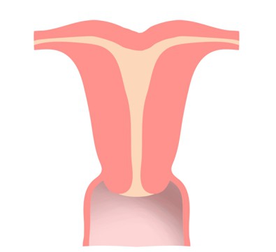 ipoplasia dell'utero