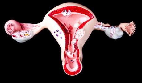 Adenomioza uterusa