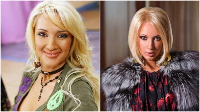 Валерия Кудрявцева преди и след пластична хирургия