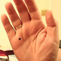 co oznaczają mole na dłoniach
