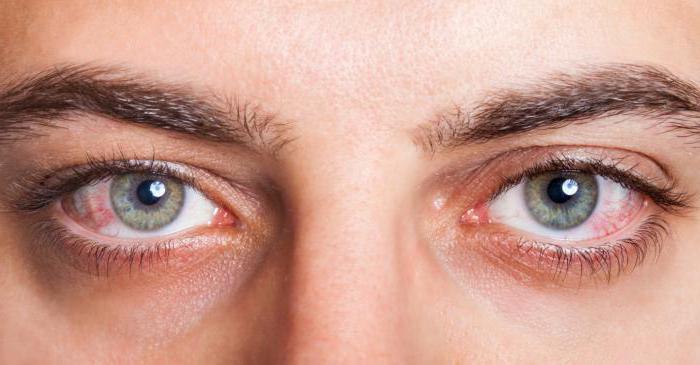 Vidisik gel oční návod k použití