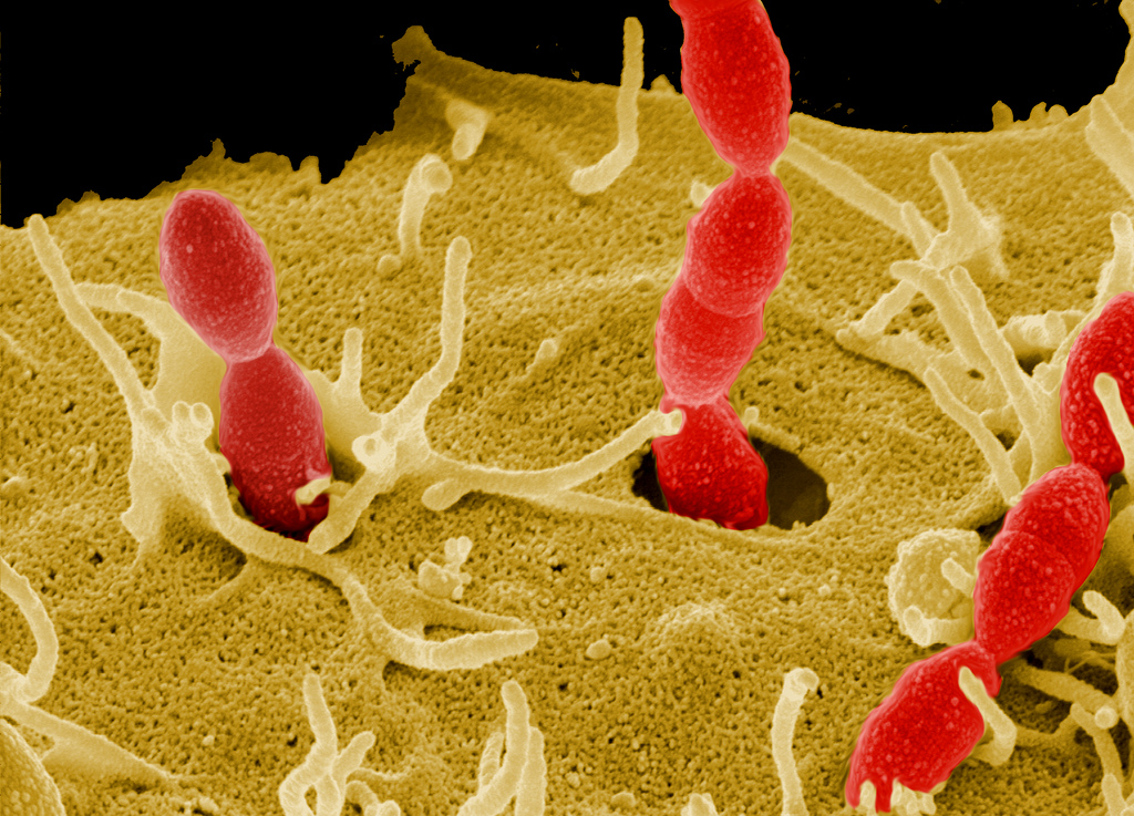 Intruzja Streptococcus do komórek gospodarza