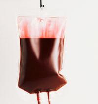 transfuzija krvi iz vene u stražnjicu