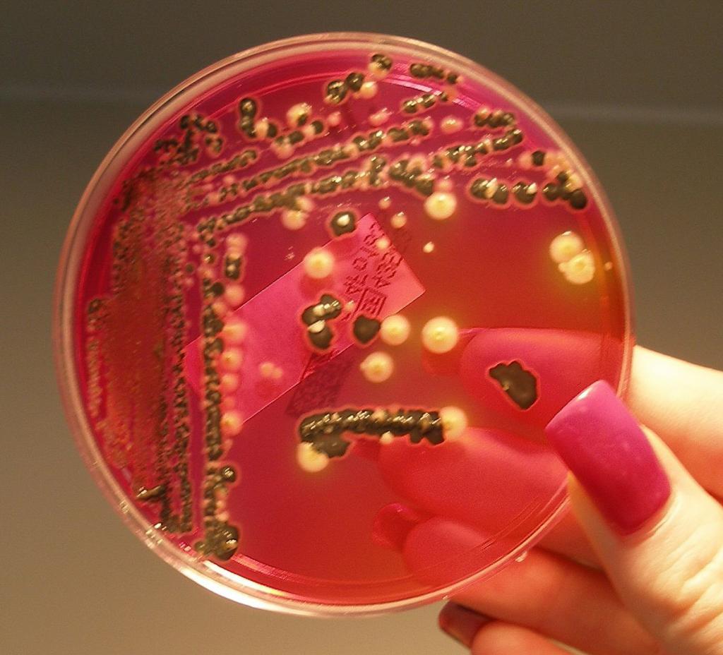 Kolonija bakterija
