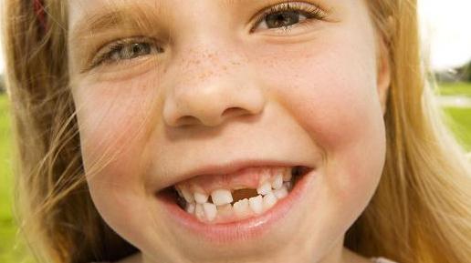 Che tipo di denti cambiano i bambini?