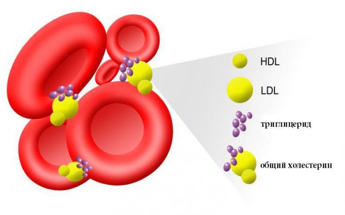 podwyższone poziomy trójglicerydów we krwi
