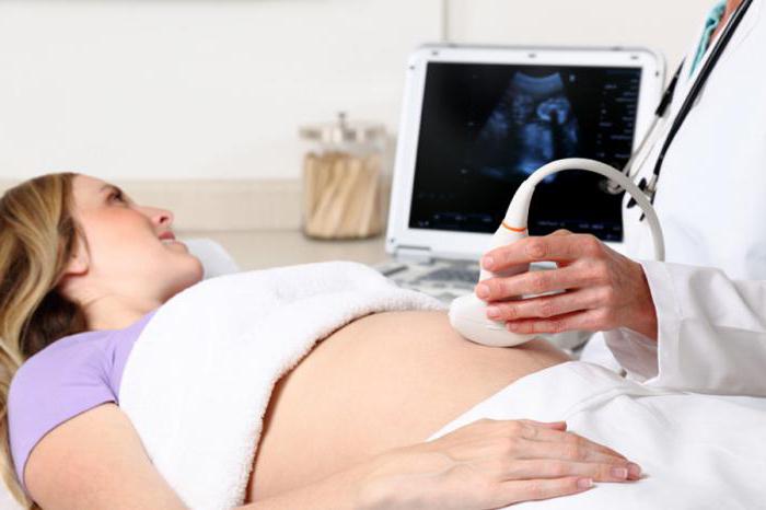 ultrazvuk zdjelice u žena koje pokazuje