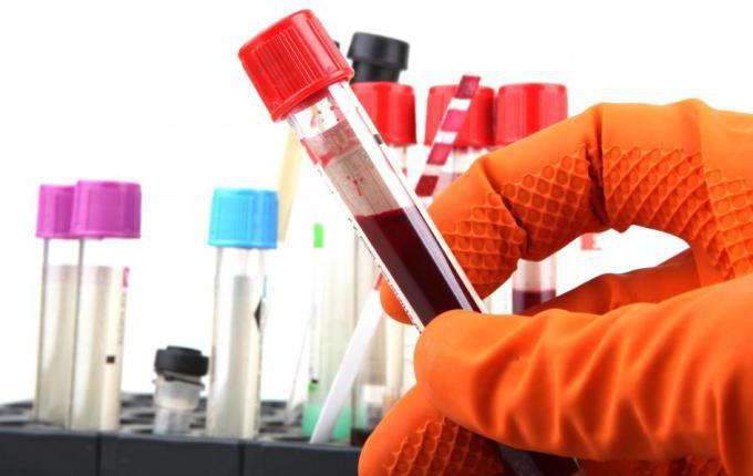 krevní test PCR na chlamydiích
