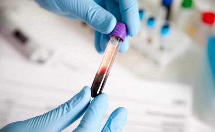 sérologický krevní test na syfilis