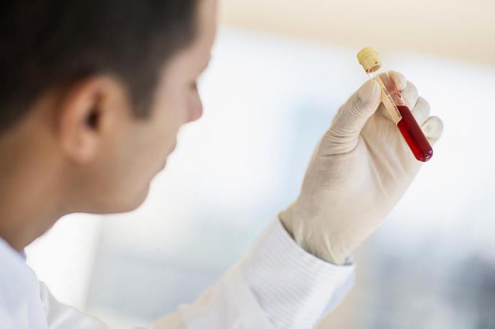 sérologický krevní test protilátek