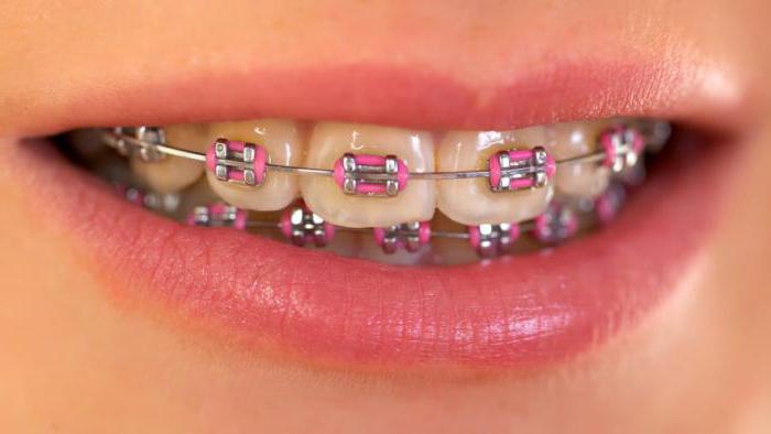 kdo so ortodonti?