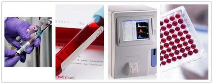 mpv transkripce krevního testu u žen