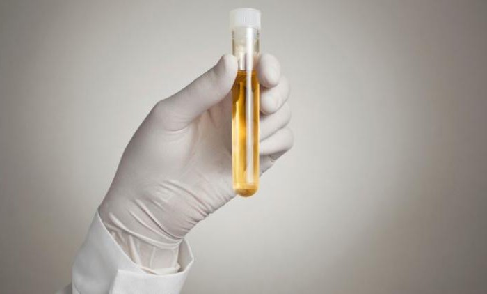 analisi delle urine che decodifica sg norm