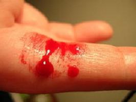krvácení před menstruací