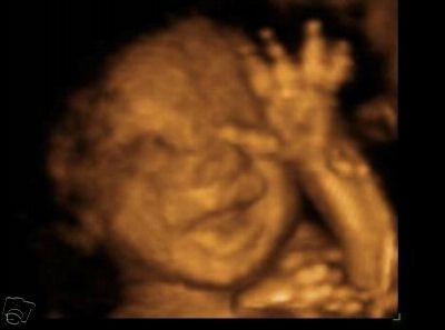 výsledky ultrazvuku během těhotenství