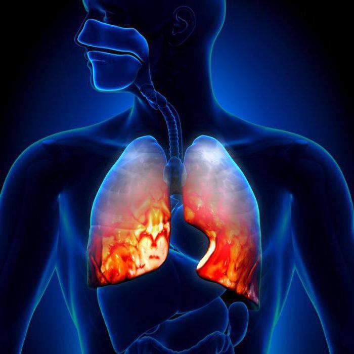 12. studenog je Svjetski dan upale pluća