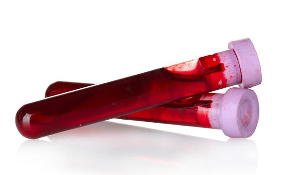 Кръвен тест: Лимфоцитите са повишени.