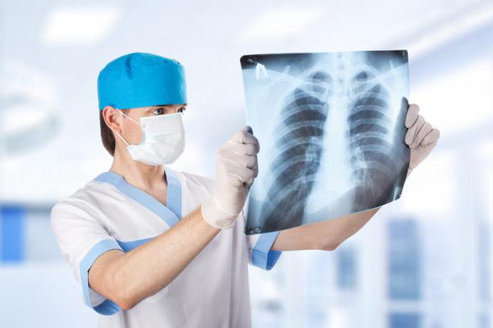 faze plućne tuberkuloze