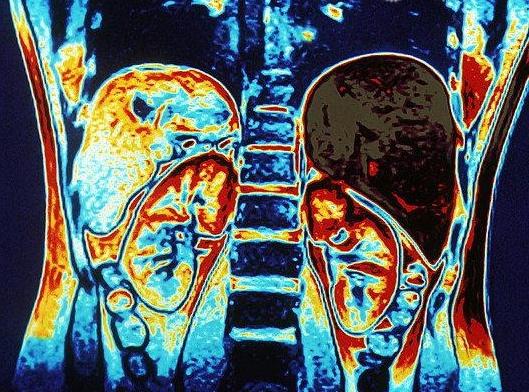 MRI trbušne šupljine