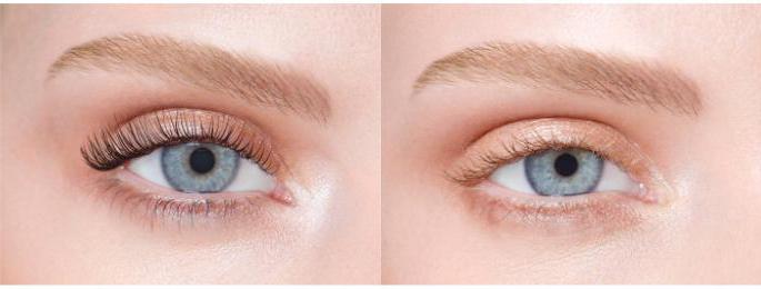 botox eyelash przegląda zdjęcia przed i po