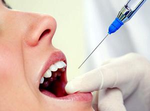 Проводима анестезия в стоматологията