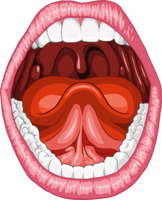Qual è la differenza tra tonsillite e tonsillite?