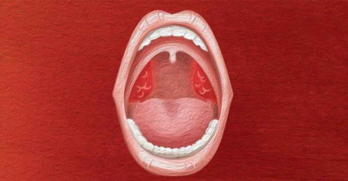Qual è la differenza tra tonsillite cronica e tonsillite?
