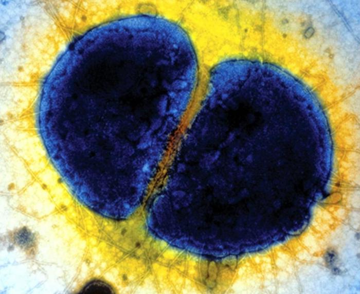 diplococcus in una macchia