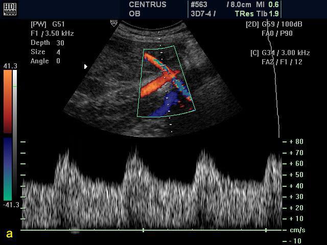ultrazvuková diagnostika