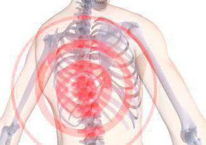 dorsopathy hrbtenice