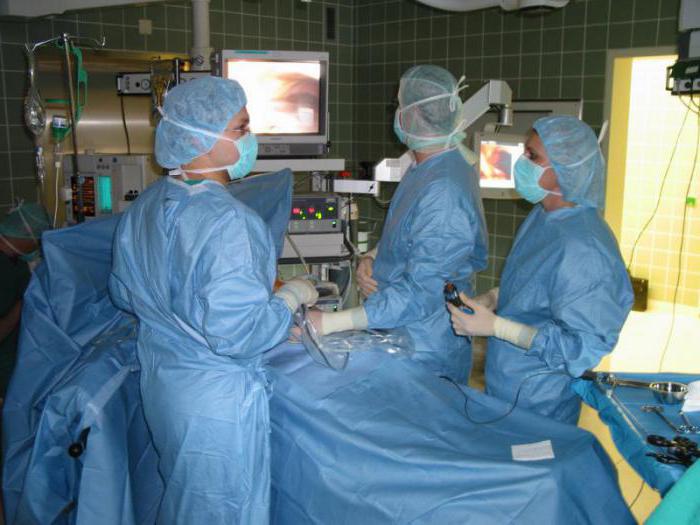 laparoskopija u ginekologiji kakva vrsta operacije