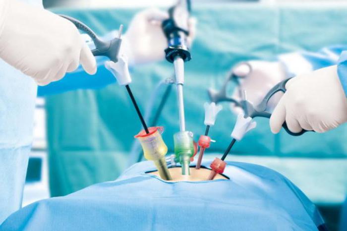 indikacije za laparoskopiju u ginekologiji