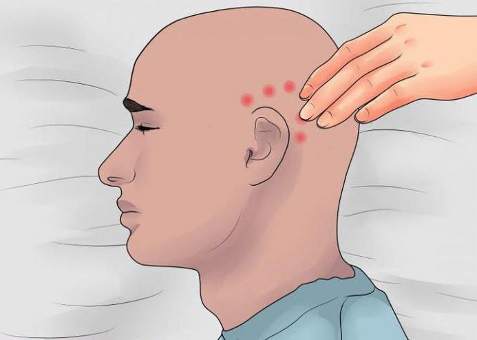 masaža migrene