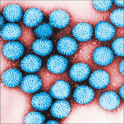 Infekce rotaviru